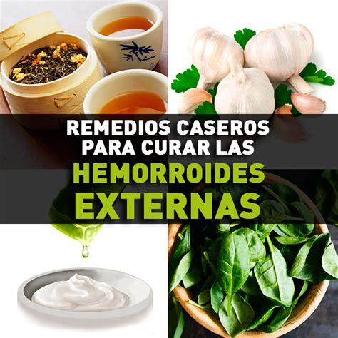 Remedios Caseros Para Curar Las Hemorroides Externas La Guía De Las