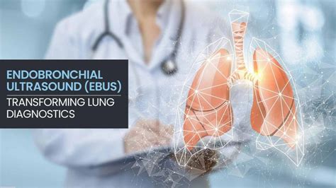 Endobronchial Ultrasound Ebus Test Revolutionizing Lung Cancer Diagnosis