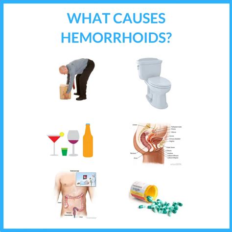 Review of Hemorrhoids Disease: Causes, Treatments, and Preventions ...