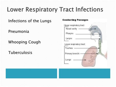 Ppt Diseases Of The Respiratory System Powerpoint Presentation Free