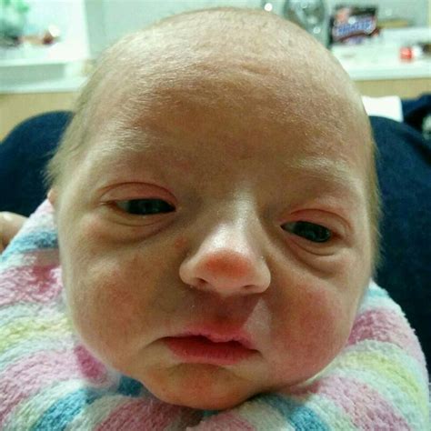 Top 10 Ugliest Babies