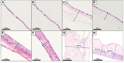 Histology Of Dried And Frozen Human Amniotic Membrane Ham And Human