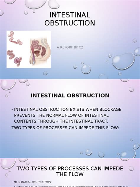 Understanding Intestinal Obstruction: Causes, Types, Signs, Symptoms, Diagnosis and Management ...