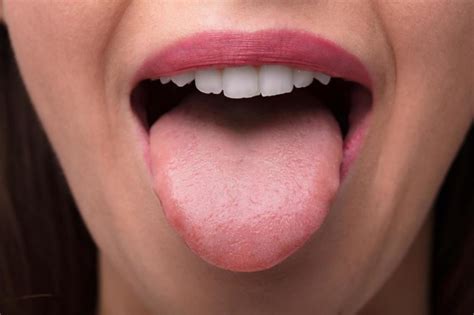 Sore Tongue: 13 Possible Causes and Treatment