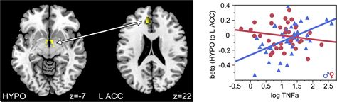 Impact Of Prenatal Maternal Cytokine Exposure On Sex Differences In