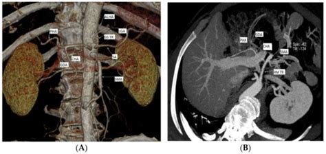 Diagnostics Free Full Text Clinical Consideration Of Anatomical