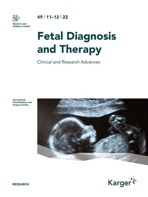 Noninvasive Prenatal Diagnosis Of Beta Thalassemia Disease By Using