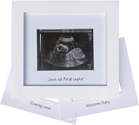 Amazon Iheipye Baby Sonogram Photo Frame St Ultrasound Picture