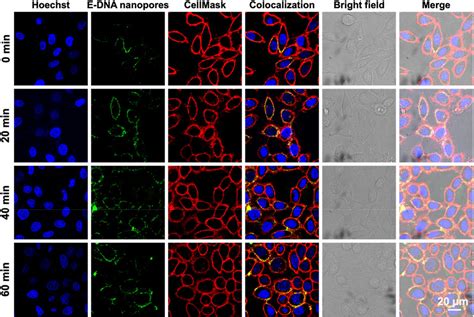 Frontiers Ethane Groups Modified DNA Nanopores To Prolong The Dwell