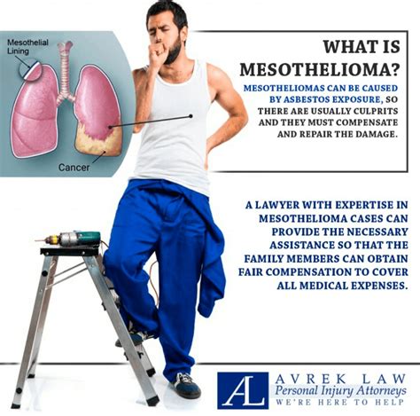 3 questions you should ask any mesothelioma lawyer in California ...