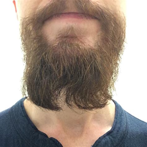 Both Sides Of My Beard Underneath My Chin Curl To The Left Is There