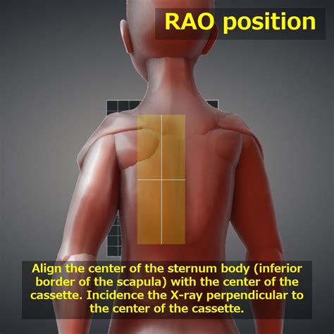 Sternum RAO PA AP ViewTools For RadTech