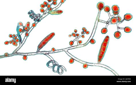 Champignons Trichophyton mentagrophytes la cause du pied de l athlète