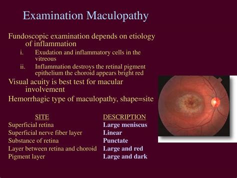 Ppt Acute Vision Loss Powerpoint Presentation Free Download Id 3000924