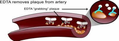 How does EDTA Chelation therapy work? (Part one) | Good Life Labs