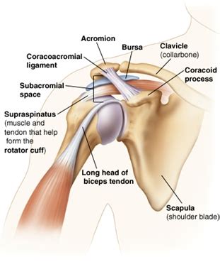 Shoulder Injury Diagram