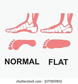 Medial Foot Anatomy Human Foot Bones Stock Vector (Royalty Free) 1075859831 | Shutterstock