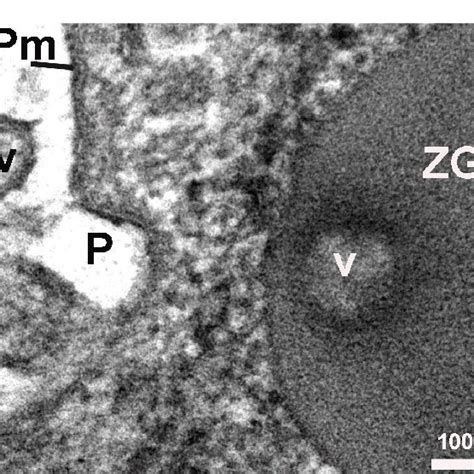 High Resolution Electron Micrograph Of A Cup Shaped Porosome P At The