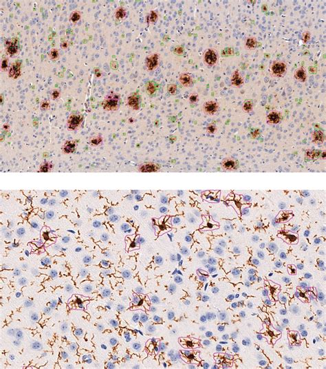 Machine Learning Supported Analyses Improve Quantitative Histological