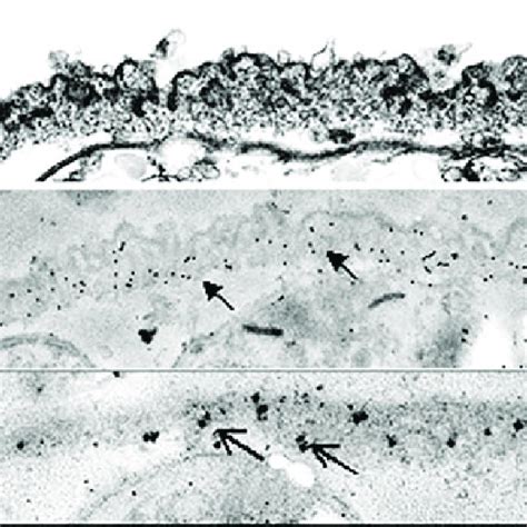 7 Distribution Of Dense Granule Proteins Gra In Bradyzoite