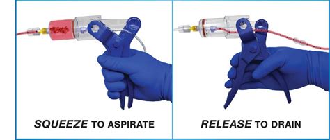 TZ Medical - Control Mechanical Thrombectomy System