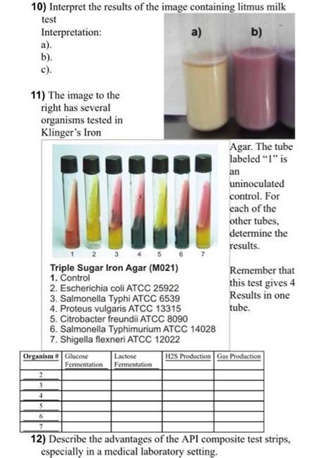 Litmus Milk Test Principle Procedure Uses And 60 Off