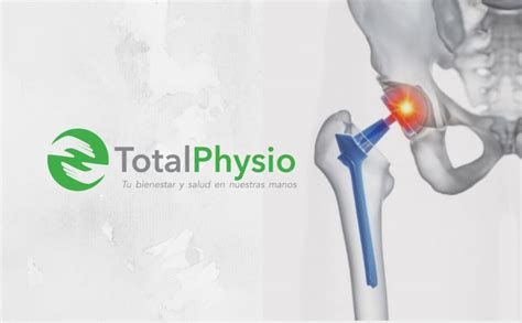 Fisioterapia En Fractura De Cadera Totalphysio