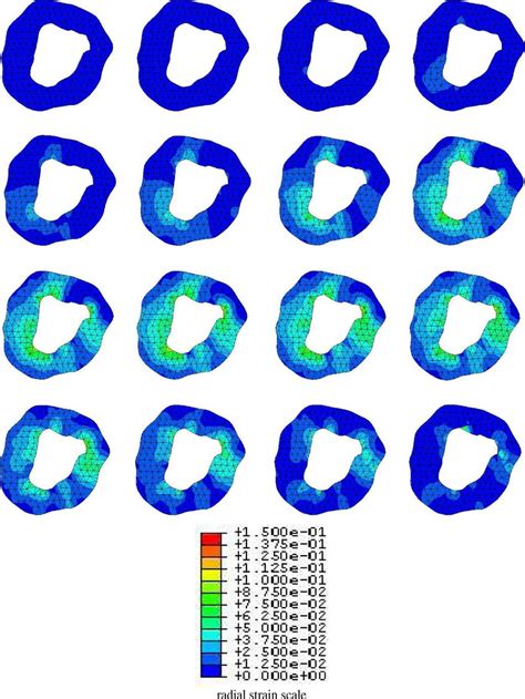 Multiframe Estimation Ks Of The Radial Strain Maps For The Mr Phase