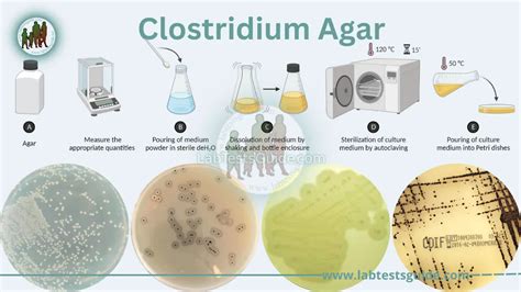 Clostridium Agar Purpose Principle Composition Results