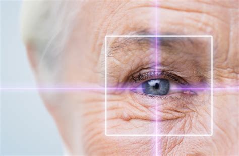 How Laser Eye Surgery For Presbyopia Works Stoney Creek