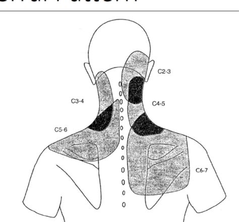 MSK Practical Cervical Thoracic Shoulder Flashcards Quizlet