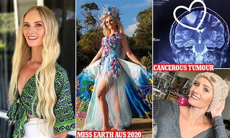 Beauty Queen Reveals The Shocking Moment She Was Diagnosed With An