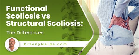 Functional Scoliosis Vs Structural Scoliosis The Differences