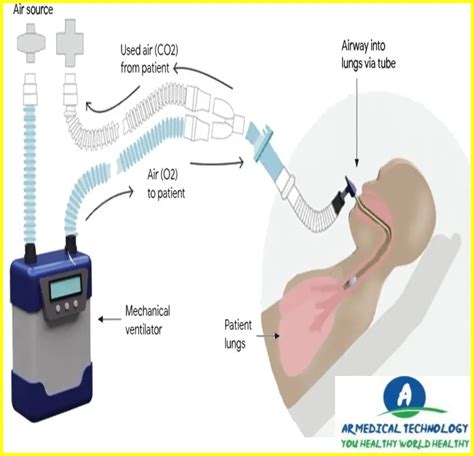 Ventilator Machine Best Way To Learn 24 Ar Medical Technology