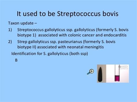 Streptococcus bovis shape | Astral Projection