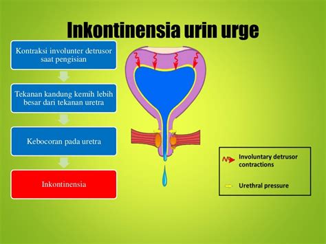 Presentasi Inkontinesia Urine