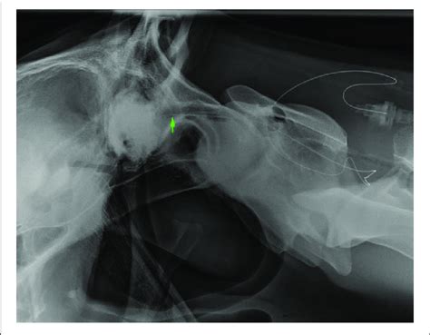 Lateral Radiograph Of Caudal Skull To Cranial C2 The Radiopaque Download Scientific Diagram