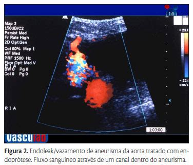 Scielo Brasil Nota T Cnica Avalia O Ultrassonogr Fica De