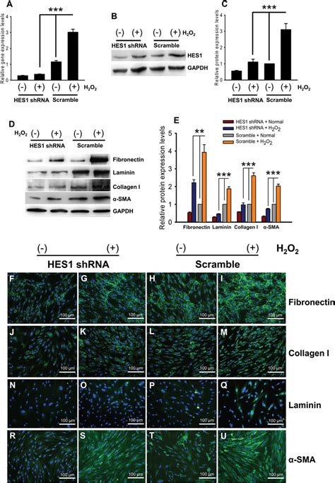 HES1 Knockdown Abrogated The Up Regulation Of ECM Proteins In The HTMCs