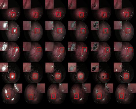 Highlight Removal Results For Benchmark Endoscopic Images A