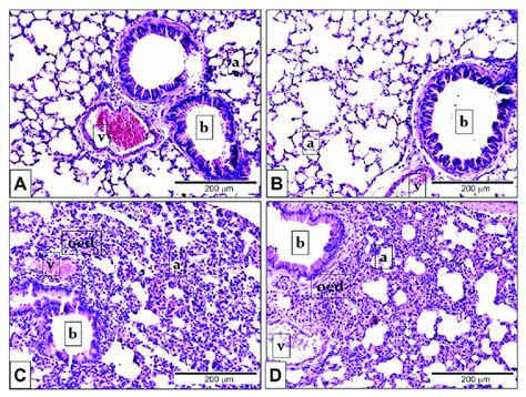 Representative Histological Pictures Of Lps Induced Pulmonary