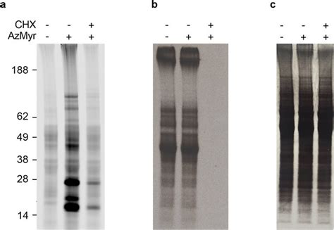 Co Versus Post Translational N Myristoylation Epimastigotes Were