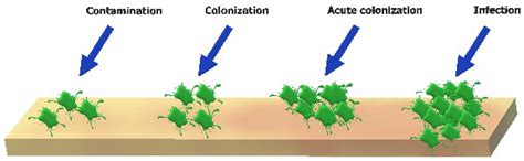 Stages Of Wound Infection