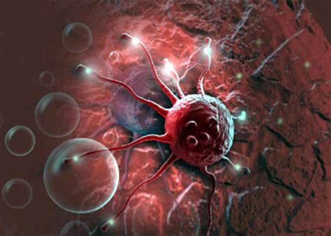 tumor lysis syndrome  symptoms criteria treatment prognosis