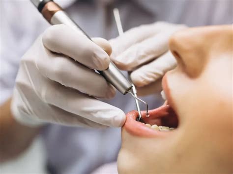 Como Feito O Desgaste Nos Dentes Para Colocar Lentes De Contato