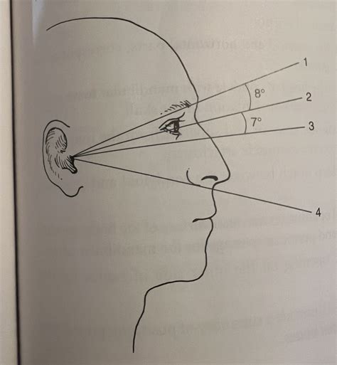 Positioning Lines Skull Diagram Quizlet