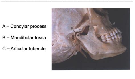 Temporomandibular Joint Tmj Flashcards Quizlet