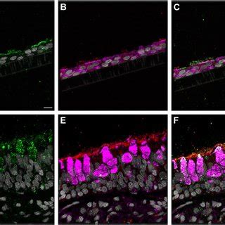 Normal Human Bronchial Epithelial NHBE Cell Types Compared To Human