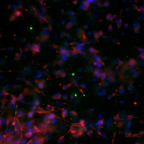SYN1-Specific antibody (20258-1-AP) | Proteintech