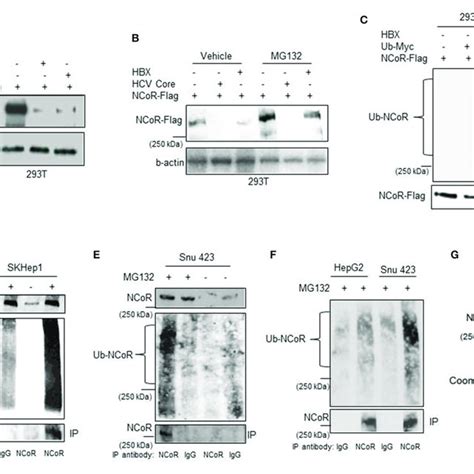 Post Transcriptional Loss Of Ncor Protein In Hbx Positive Hcc Cells